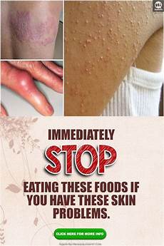 Herbal Foods